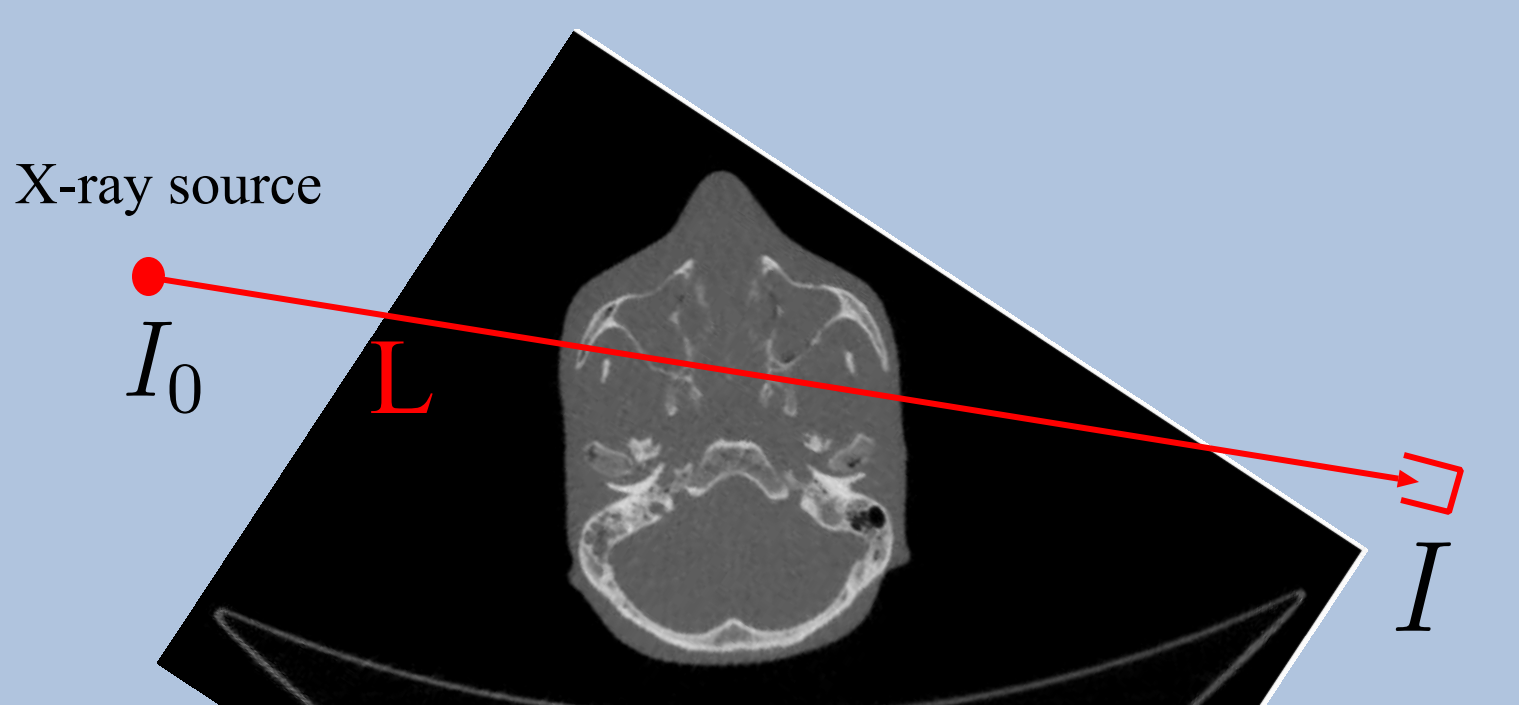 Computed Tomography (CT)